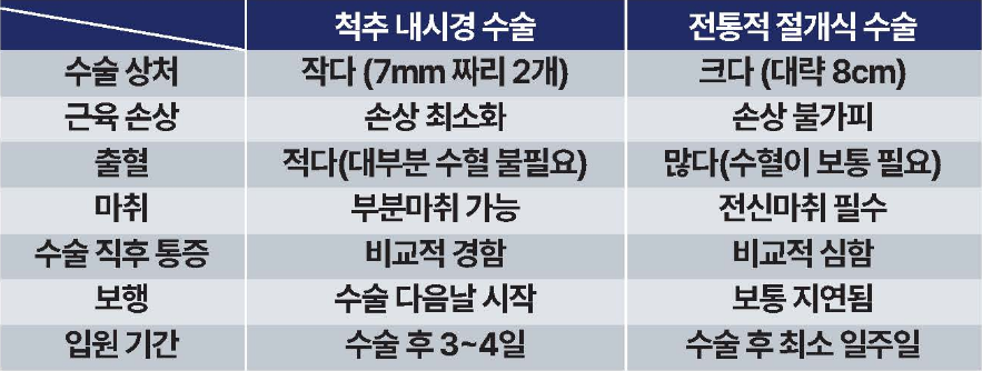 척추내시경vs절개식 비교