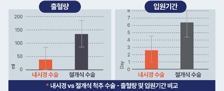 척추내시경 입원기간